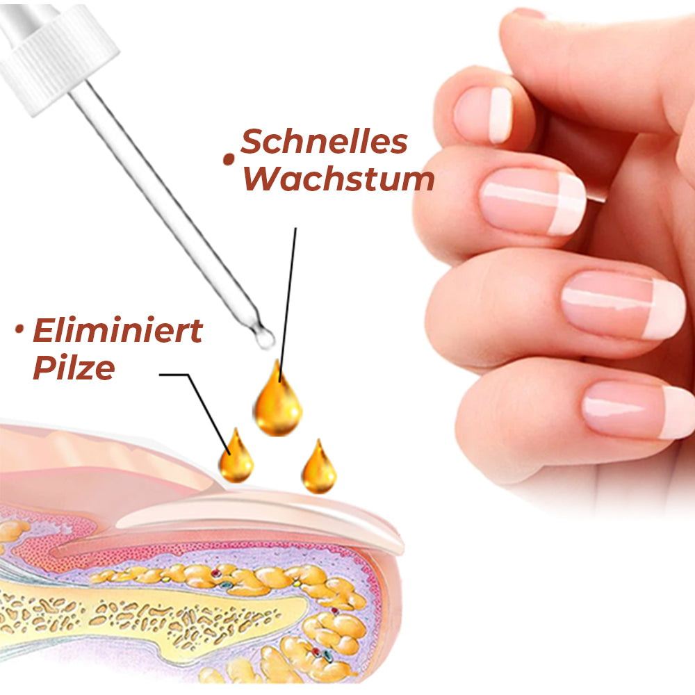 Furzero™ 7 Tage Nägel reparieren Essenz