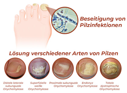 Furzero™ 7 Tage Nägel reparieren Essenz