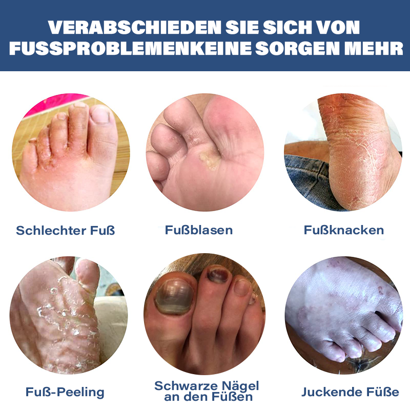 Furzero™ Medizinisches Nagelpilz-Fußspray T