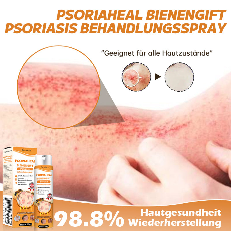 👍🐝Furzero™ PsoriaHeal Bienengift Psoriasis Behandlungsspray(Geeignet für alle Hauttypen)