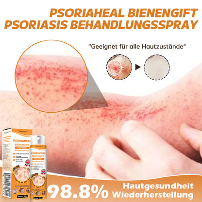 Furzero™ PsoriaHeal Bienengift Psoriasis Behandlungsspray(Geeignet für alle Hauttypen)