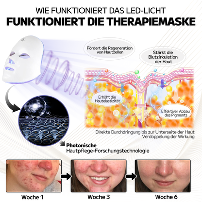 Ourlyard™ Laserbehandlungsmaske für Rosacea