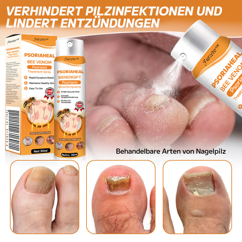 Furzero™ PsoriaHeal Bienengift Psoriasis Behandlungsspray(Geeignet für alle Hauttypen)