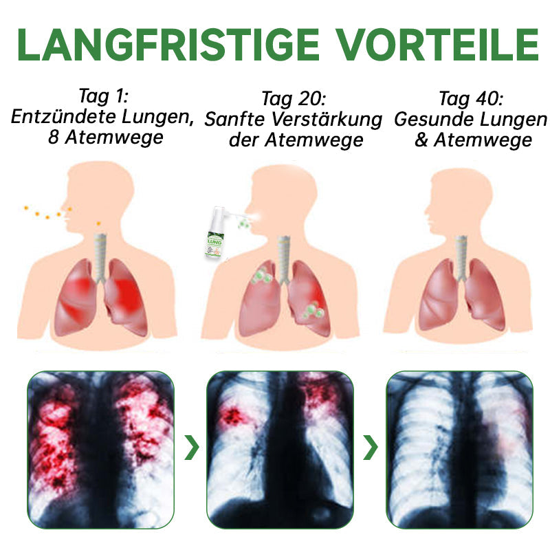 Ourlyard™ Kräuterlungenreinigungs- und Reparaturspray Plus