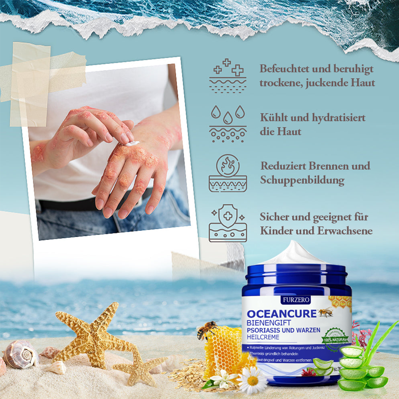 🌞Furzero™ OceanCure Bienengift Psoriasis und Warzen Heilcreme