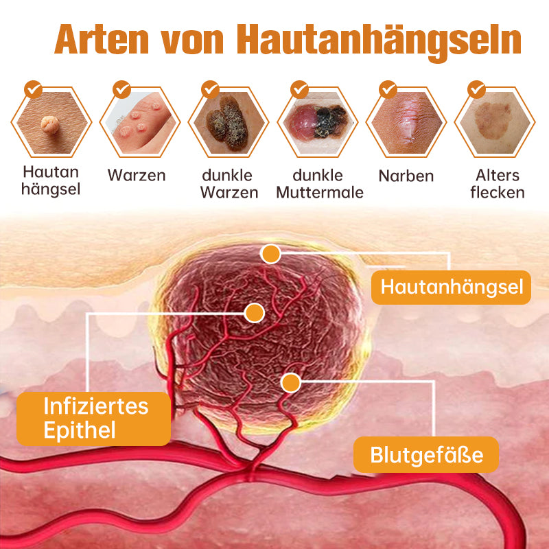 Ourlyard™  WartGone Bienengift-Behandlungspflaster