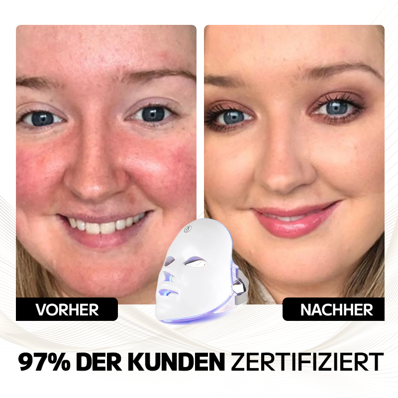 Ourlyard™ Laserbehandlungsmaske für Rosacea