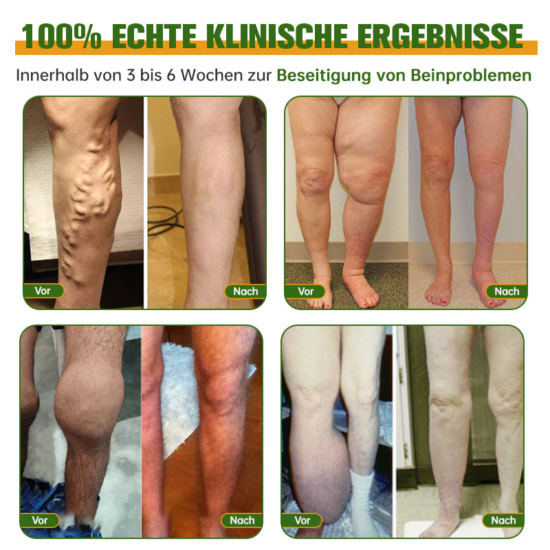 🐝🐝🐝Furzero™ Bienengift Lymphdrainage & Schlankheits-Fußbadperle -  Von NIH-Experten empfohlen