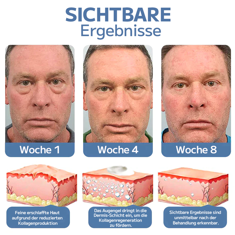 🍀OPENEYES Erwachen Peptid-Straffendes Augengel