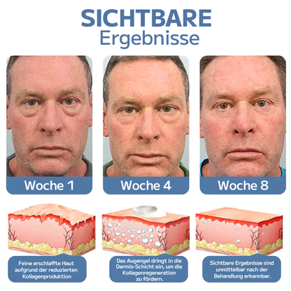 🍀OPENEYES Erwachen Peptid-Straffendes Augengel