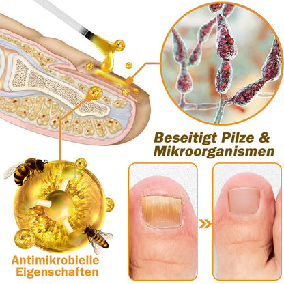 🐝Furzero™ Nagelverteidigung Bienengift-Behandlungsserum