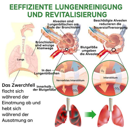 Furzero™️ Atementgiftendes Kräuterlungenreinigungsspray Plus