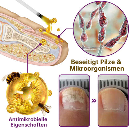 🐝flysmus™ FungiFree Bienengift Nagelbehandlungsserum