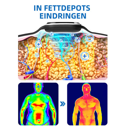 💪GFOUK™ Ultraschall-Fettabbau- und Entgiftungsarmband (🔥LETZTER TAG 70% RABATT)