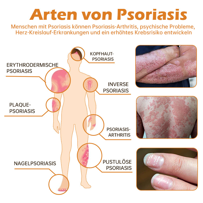 👍🐝Furzero™ PsoriaHeal Bienengift Psoriasis Behandlungsspray(Geeignet für alle Hauttypen)