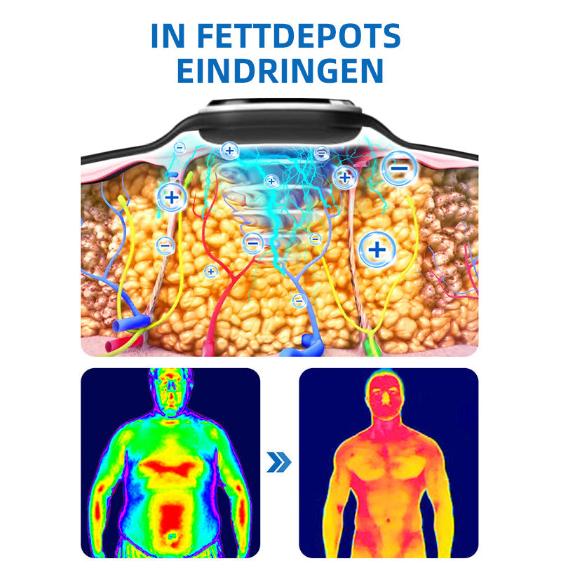 🐮GFOUK™ Ultraschall-Fettabbau- und Entgiftungsarmband (🔥LETZTER TAG 70% RABATT)