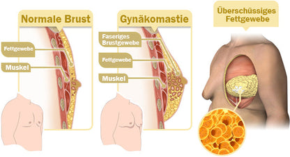 Furzero™ MenRobust Bienengift Gynäkomastie Heizöl