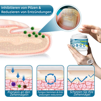 Ourlyard™  Multi-Symptom Psoriasis-Behandlungscreme（👨‍⚕Vom Arzt empfohlen）