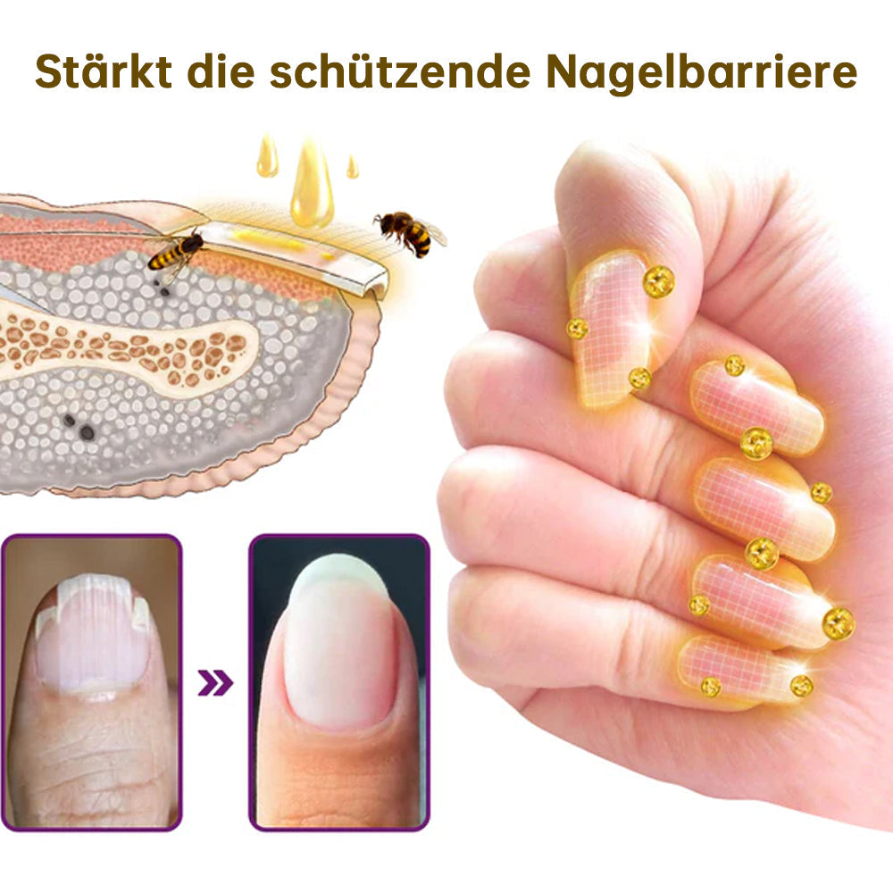 🐝flysmus™ Fungus-Free Bienengift Nagelbehandlungsserum