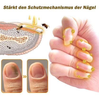 🐝Furzero™ Nagelverteidigung Bienengift-Behandlungsserum