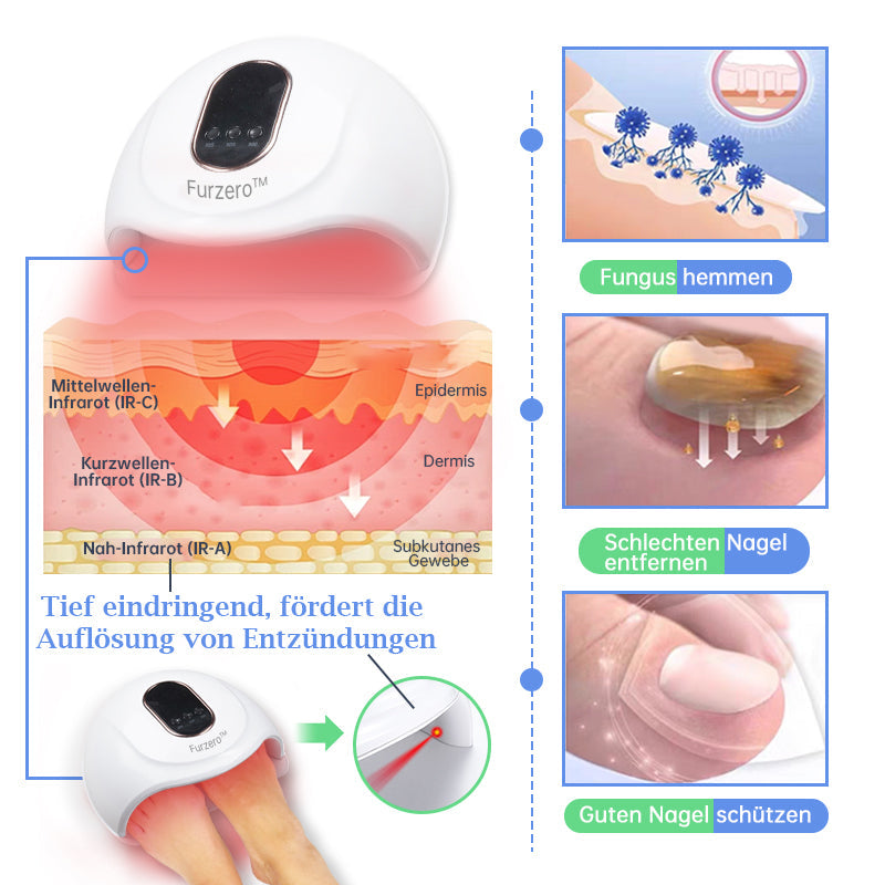 Furzero™ PureNailRENEW Lasertherapie Set