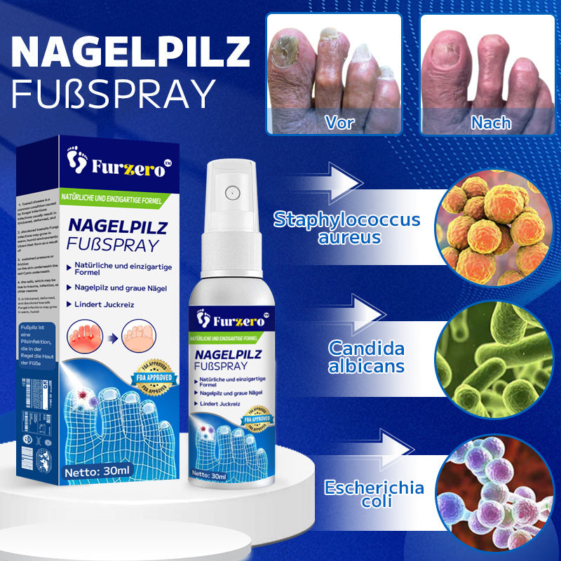 🔥 Furzero™ Nagelpilz-Fußspray