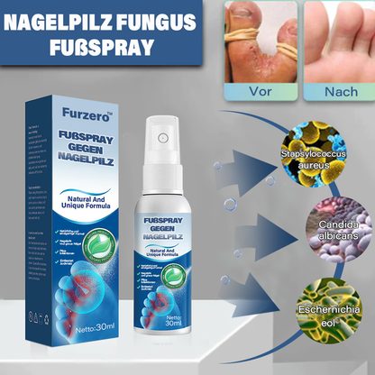 Furzero™ Medizinisches Nagelpilz-Fußspray T