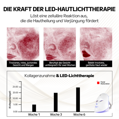 Ourlyard™ Laserbehandlungsmaske für Rosacea