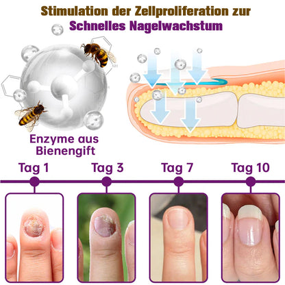 🐝flysmus™ Fungus-Free Bienengift Nagelbehandlungsserum