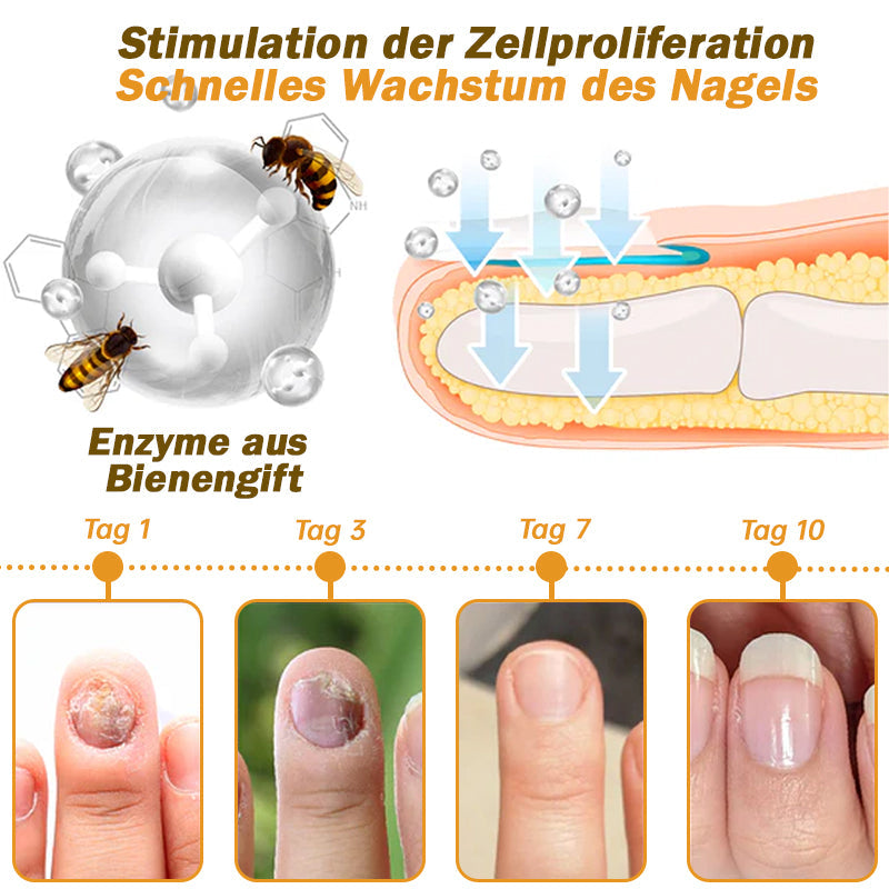 🐝Furzero™ Nagelverteidigung Bienengift-Behandlungsserum