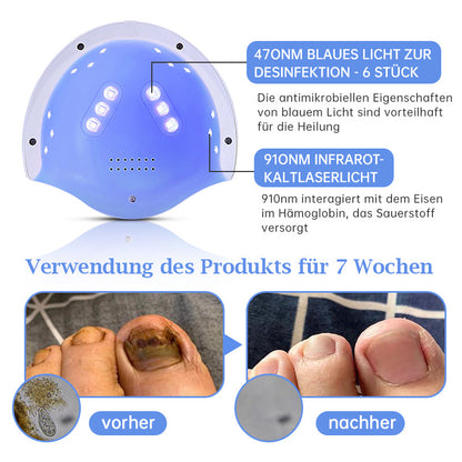 Furzero™ PureNailRENEW Lasertherapie Set