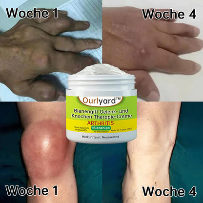 Ourlyard™ Bienengift Gelenk- und Knochen-Therapie-Creme (Vollständige Körpererholung, reine natürliche Formel)