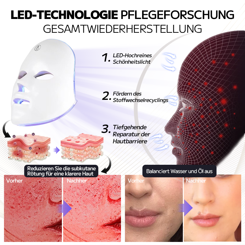 Ourlyard™ Laserbehandlungsmaske für Rosacea