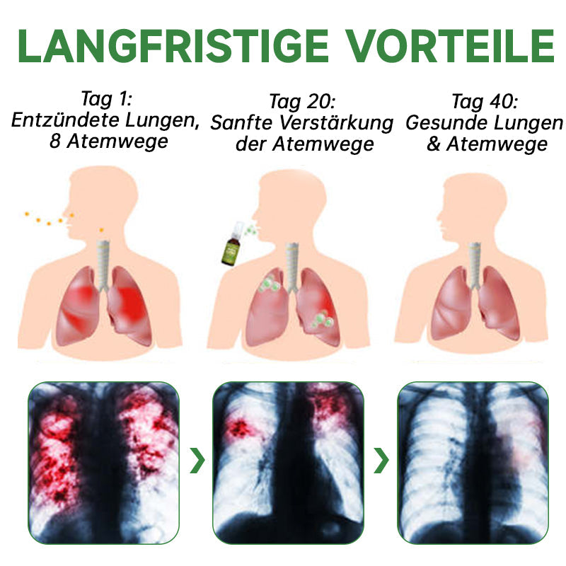 Furzero™️ Atementgiftendes Kräuterlungenreinigungsspray Plus