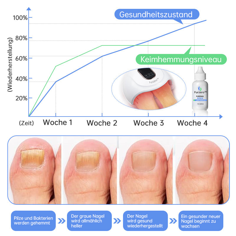 Furzero™ PureNailRENEW Lasertherapie Set