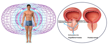 Sugoola™ Männer IONIC Energiefeld-Therapie Mag Kompression Shorts🐍