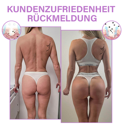 Furzero™ Gesäßverstärkende Formung Creme