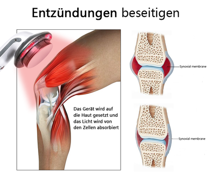 Ourlyard™ Handgerät zur Kaltlaser-Schmerzbehandlung