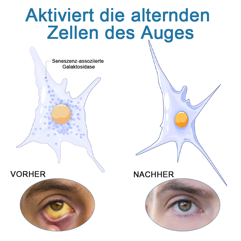 Ourlyard™ Behandlung Augenprobleme Lösung Tropfen