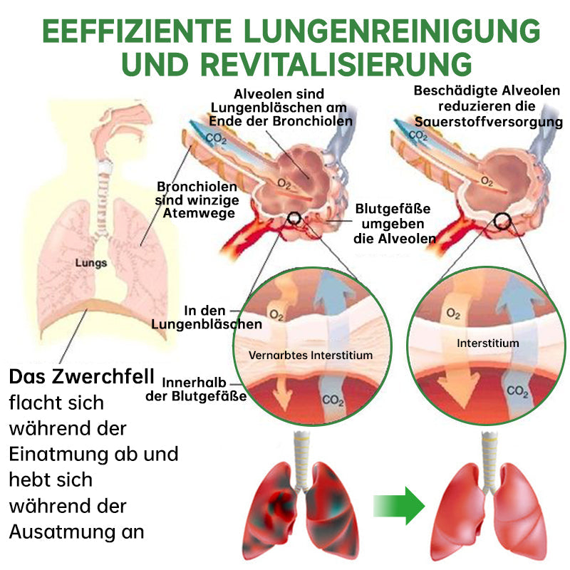 Furzero™ Atementgiftendes Kräuterlungenreinigungsspray