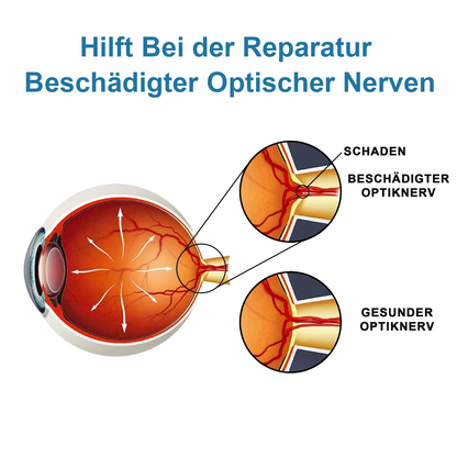 Ourlyard™ Behandlung Augenprobleme Lösung Tropfen