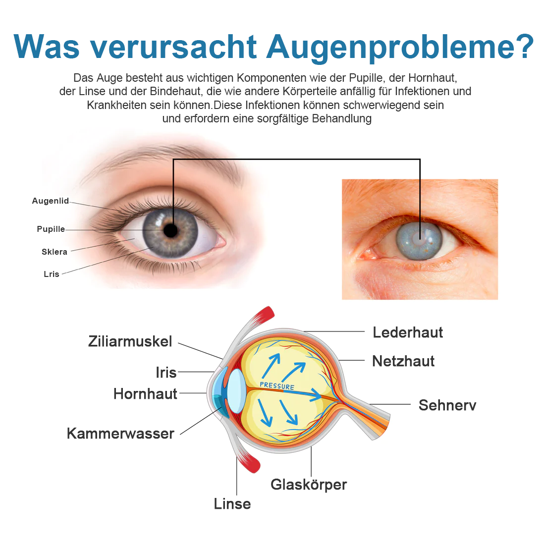 Ourlyard™ Behandlung Augenprobleme Lösung Tropfen