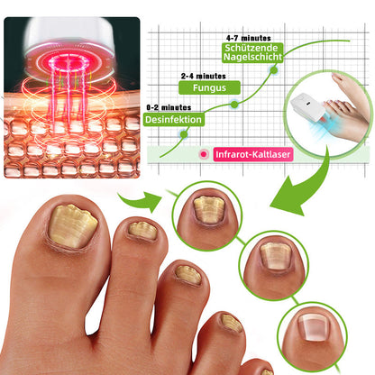 🍀Furzero™ Nagelpilz-Laserbehandlungsgerät