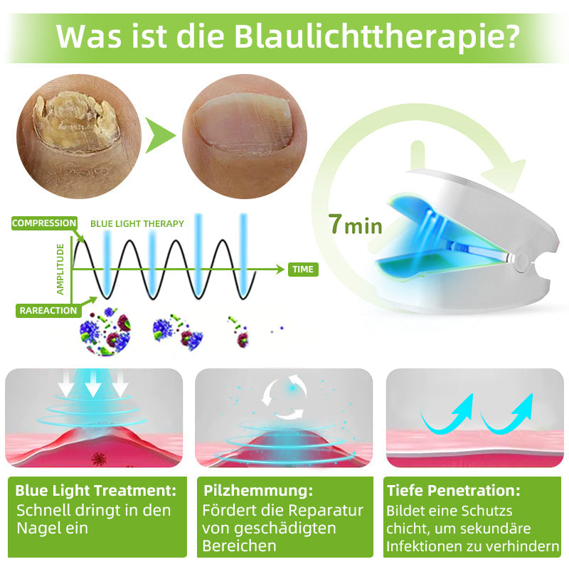 🍀Furzero™ Nagelpilz-Laserbehandlungsgerät🍀